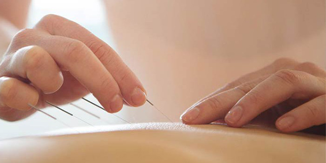 Akupunktura kao savršena medicina ENERGETSKA RAVNOTEŽA BEZ LEKOVA